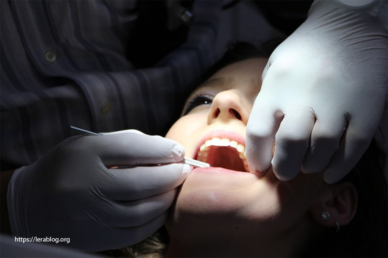 Infection Prevention After Dental Implant Surgery