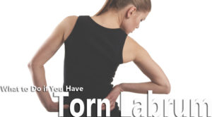 What to Do if You Have a Torn Labrum